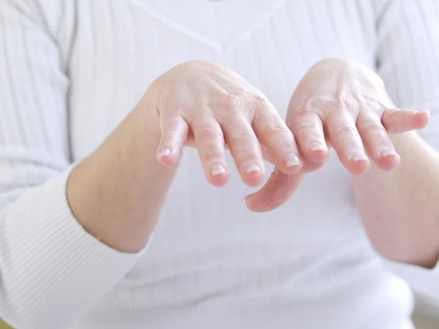 O que é Parkinson Pediátrico? Tratamento e Cura - Tudo aqui